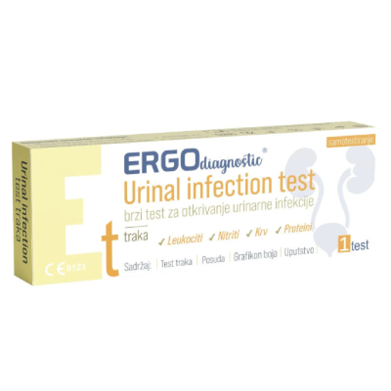 Ergo diagnostički test za urinarne infekcije a 1